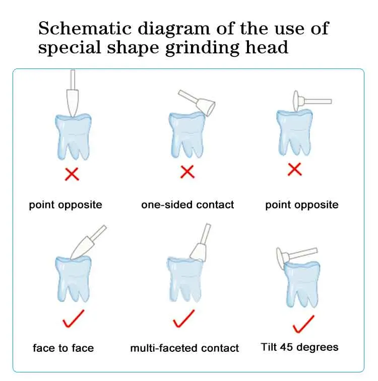 Dental Aesthetic Resin Composite Polishing