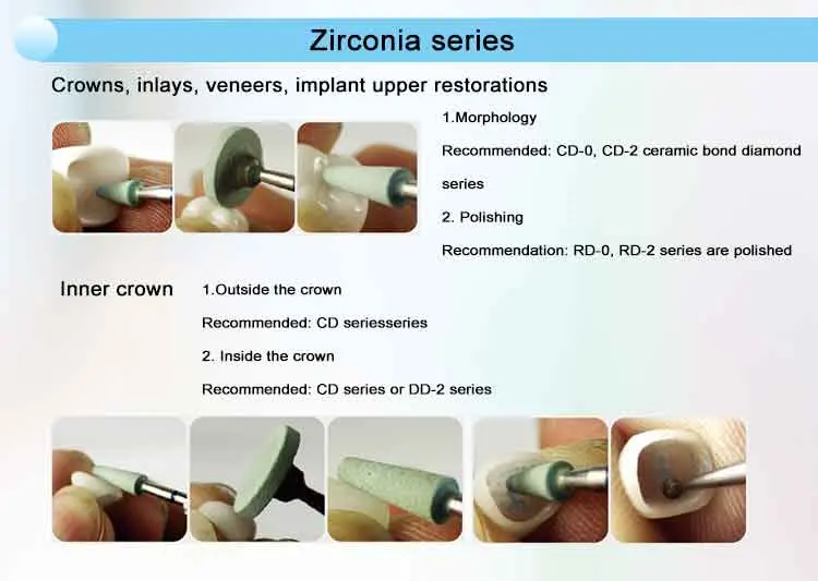 Dental Aesthetic Resin Composite Polishing